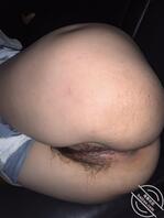 自拍。有人知道是什么穴吗？