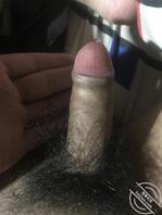 讨论一下大家棒棒都是多大1