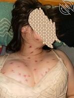 记录女神老婆减肥前被亲满胸吻痕2