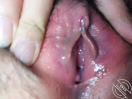 【原创】有人说黑！不可能是处女！现在信了吧，处女膜都能看到。0