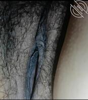 少妇私密外检，大家一起诊疗下2