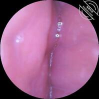 【家庭真实系列】内窥镜探索老婆淫穴内部结构0