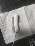 女儿的小b为什么不吸收0