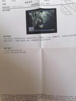 （原创）28环环是歪了，真希望骚妈怀孕了生下小女儿继续乱伦