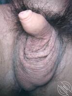 有喜欢包皮小鸡巴的吗？0