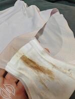 沂水媳妇穿了两天就这样了，是大姨妈没走干净嚒1